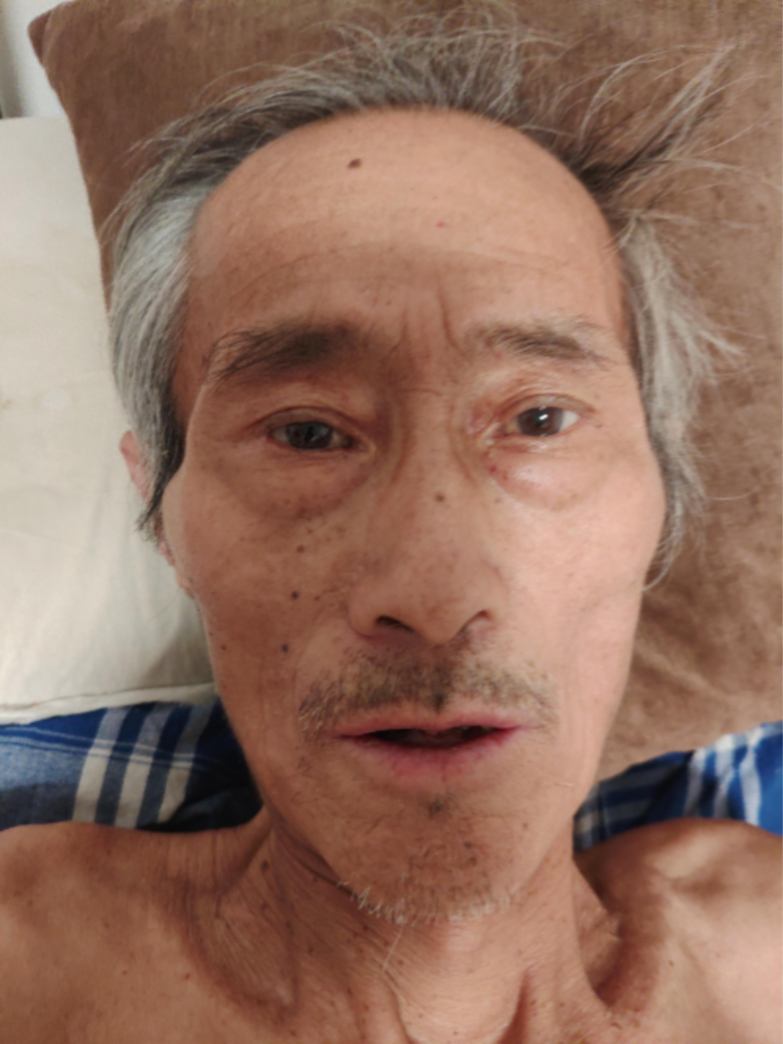 走失者照片 邯郸市寻亲：七旬老人被救助，自述叫...