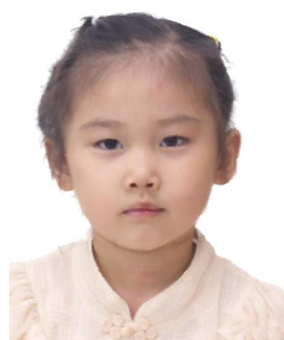 走失者照片 重庆寻亲：4岁女孩被救助多年