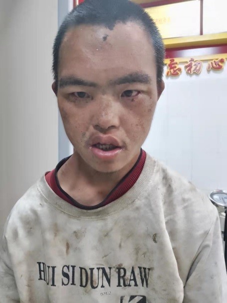走失者照片 泸州急寻：青年男子被救助，疑似精神...
