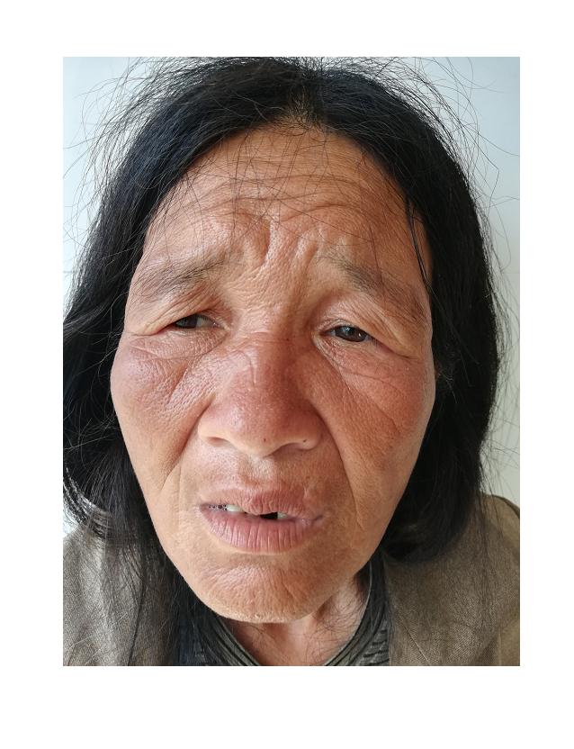 走失者照片 厦门寻亲：五旬女子被救助，穿条纹打...