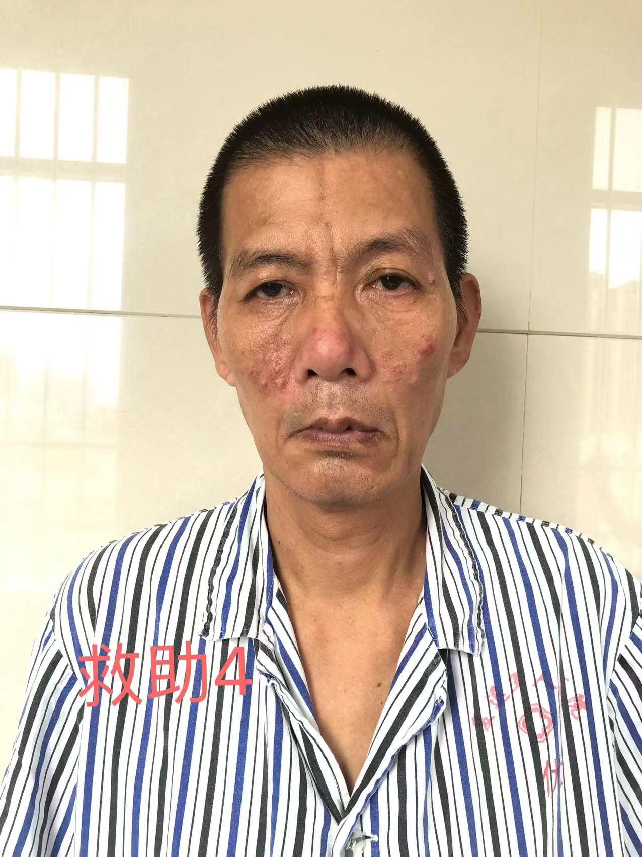 走失者照片 南宁寻亲：五旬男子被救助，语无伦次...