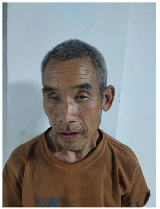 走失者照片 周口寻亲：五旬男子被救助，穿暗橙色...