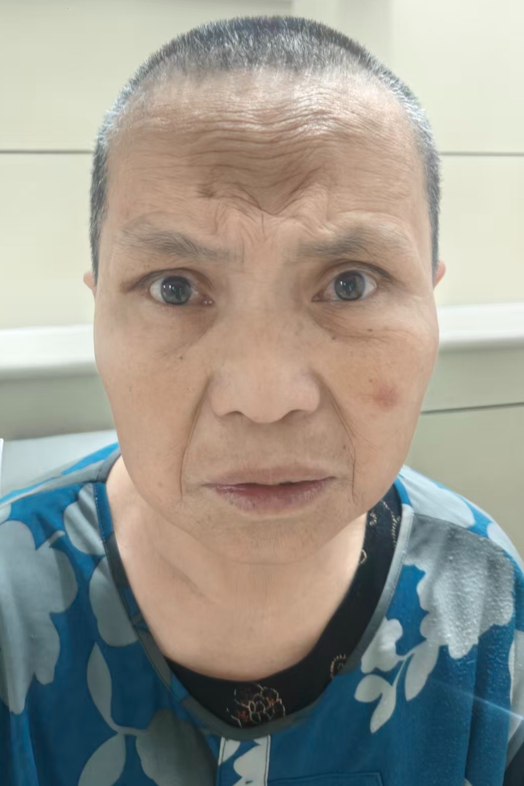 走失者照片 全国救助站
