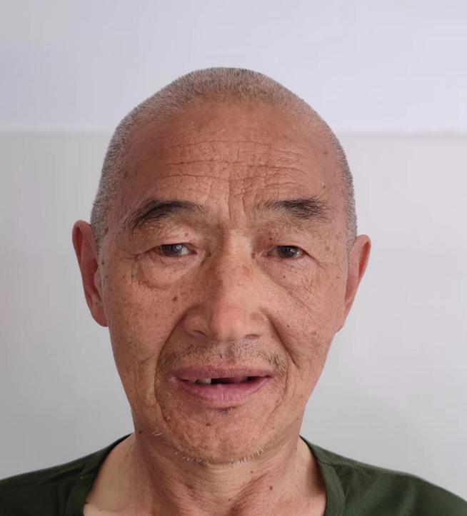 走失者照片 潍坊寻亲：六旬老人被救助，穿白色上...