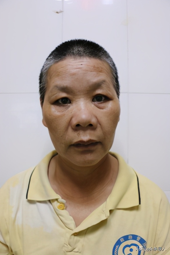 走失者照片 郴州寻亲：五旬女子被救助多年，花白...
