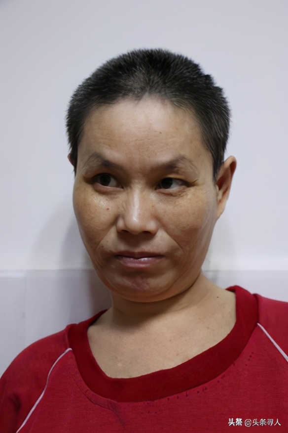 走失者照片 郴州寻亲：中年女子被救助多年，患精...