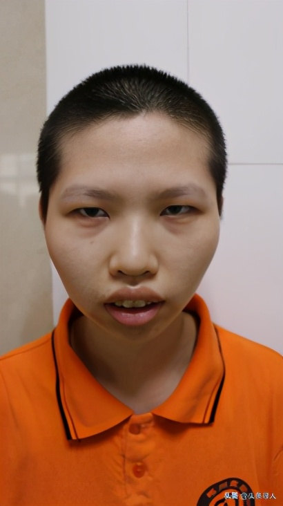 走失者照片 郴州寻亲：青年女子被救助多年，患精...