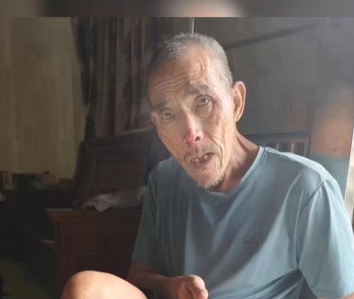 走失者照片 清远急寻：六旬老人走失，患精神障碍...