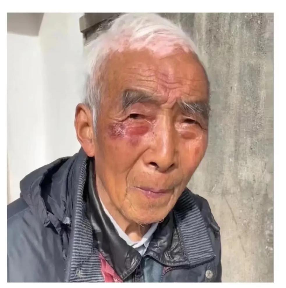 走失者照片 外公您在哪儿？泰州靖江八旬老人走失...