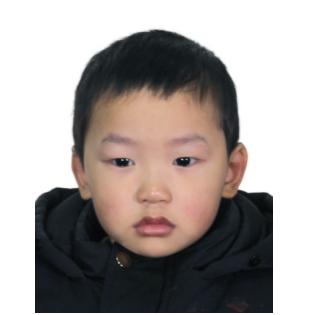 走失者照片 重庆寻亲：4岁男童被救助，背上有汤...
