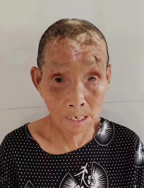 走失者照片 漯河寻亲：六旬老太被救助多年，聋哑...