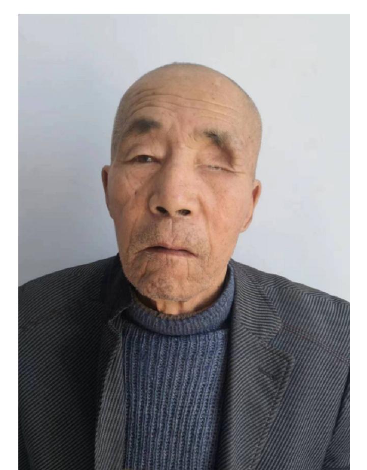 走失者照片 松原寻亲：七旬老人被救助，自述叫刘...
