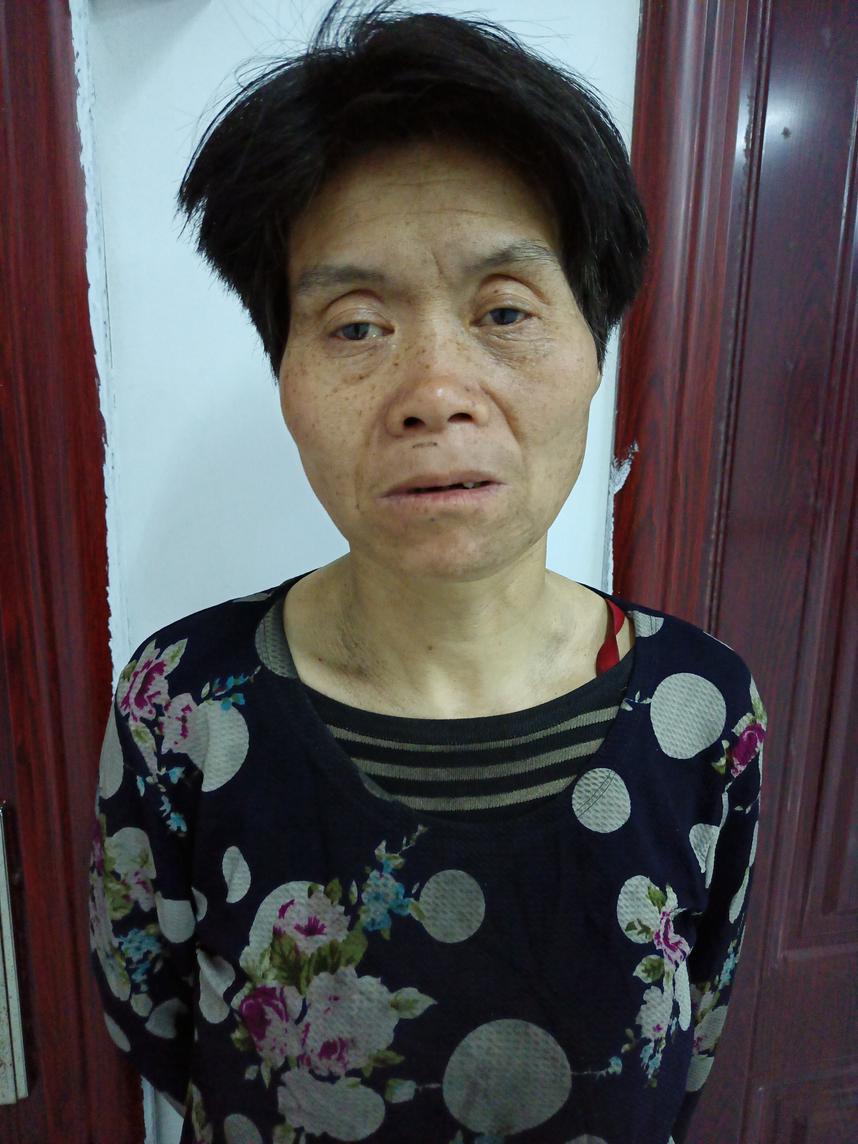 走失者照片 聊城市寻亲：六旬老太被救助，疑似精...