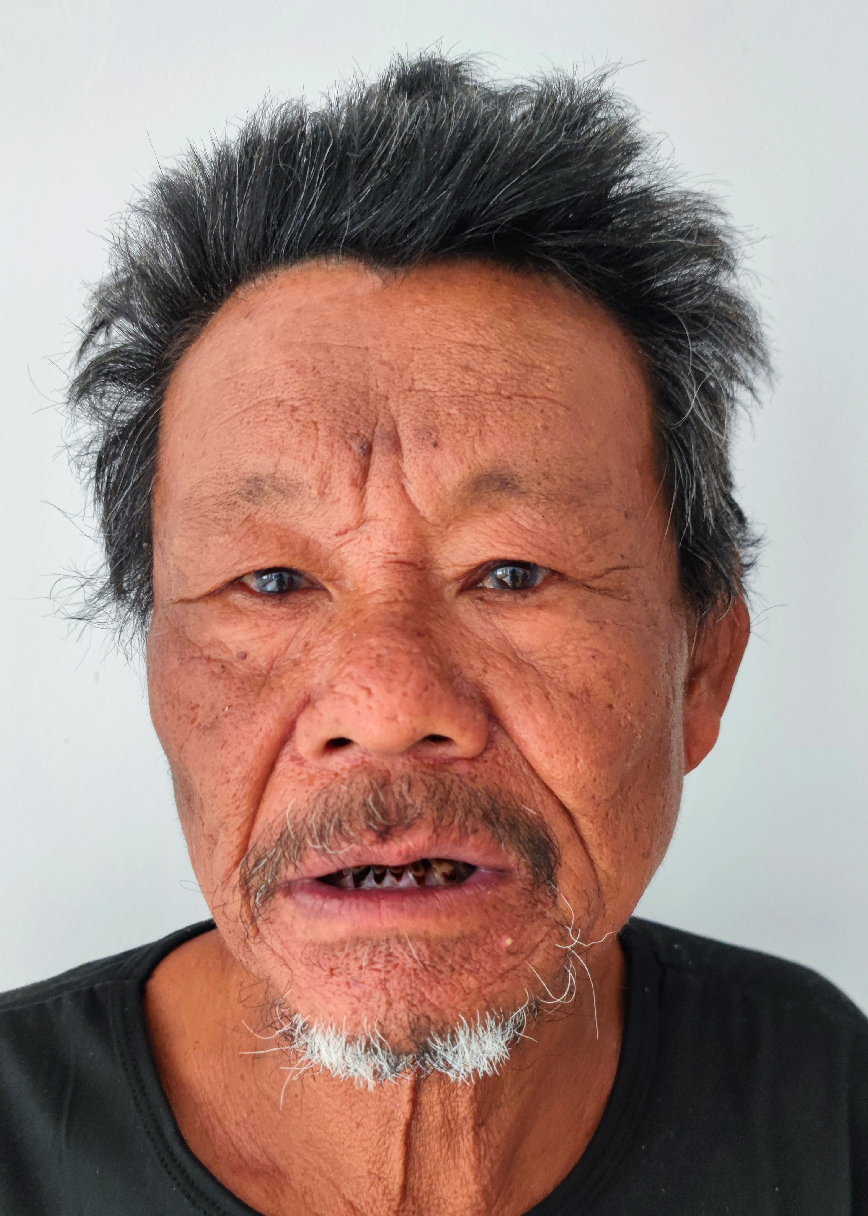 走失者照片 厦门寻亲！六旬老人被救助，自写名叫...