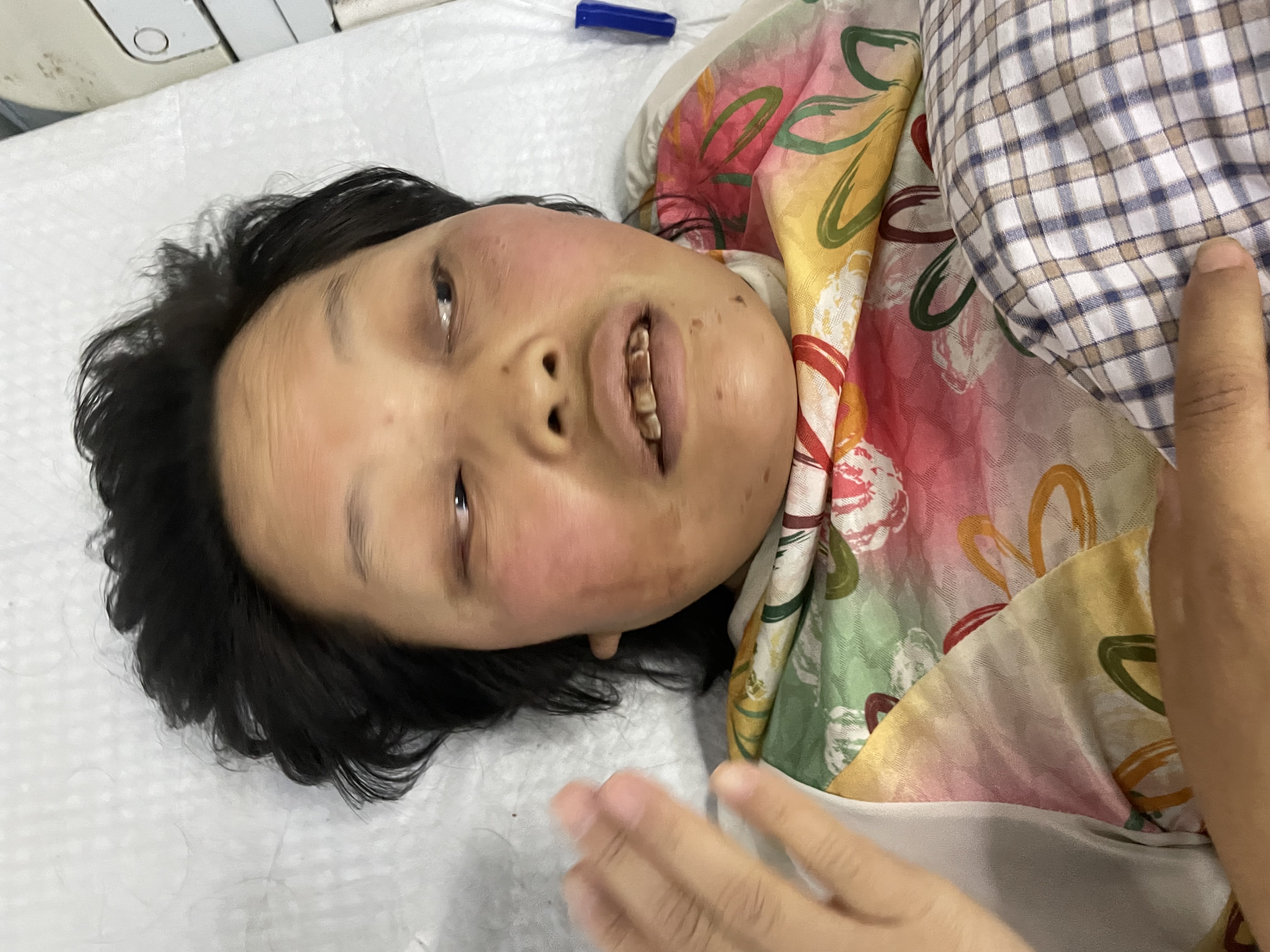 走失者照片 衡阳耒阳寻亲：中年女子被救助，穿花...