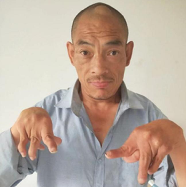 走失者照片 信阳寻亲：五旬男子被救助，穿迷彩衣...
