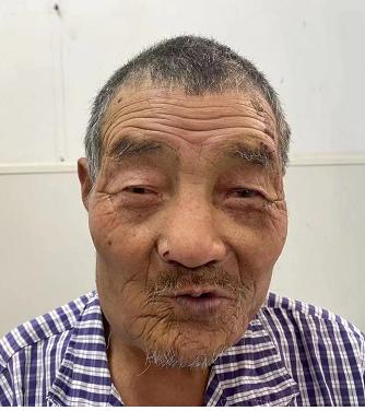 走失者照片 天津寻亲：七旬老人被救助，高1米6...