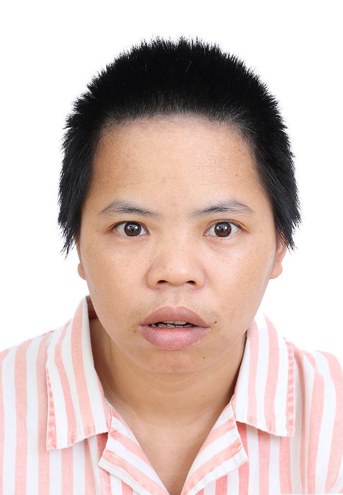 走失者照片 佛山寻亲：青年女子被救助多年，疑似...