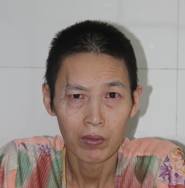 走失者照片 漯河寻亲：中年女子被救助数年，高1...