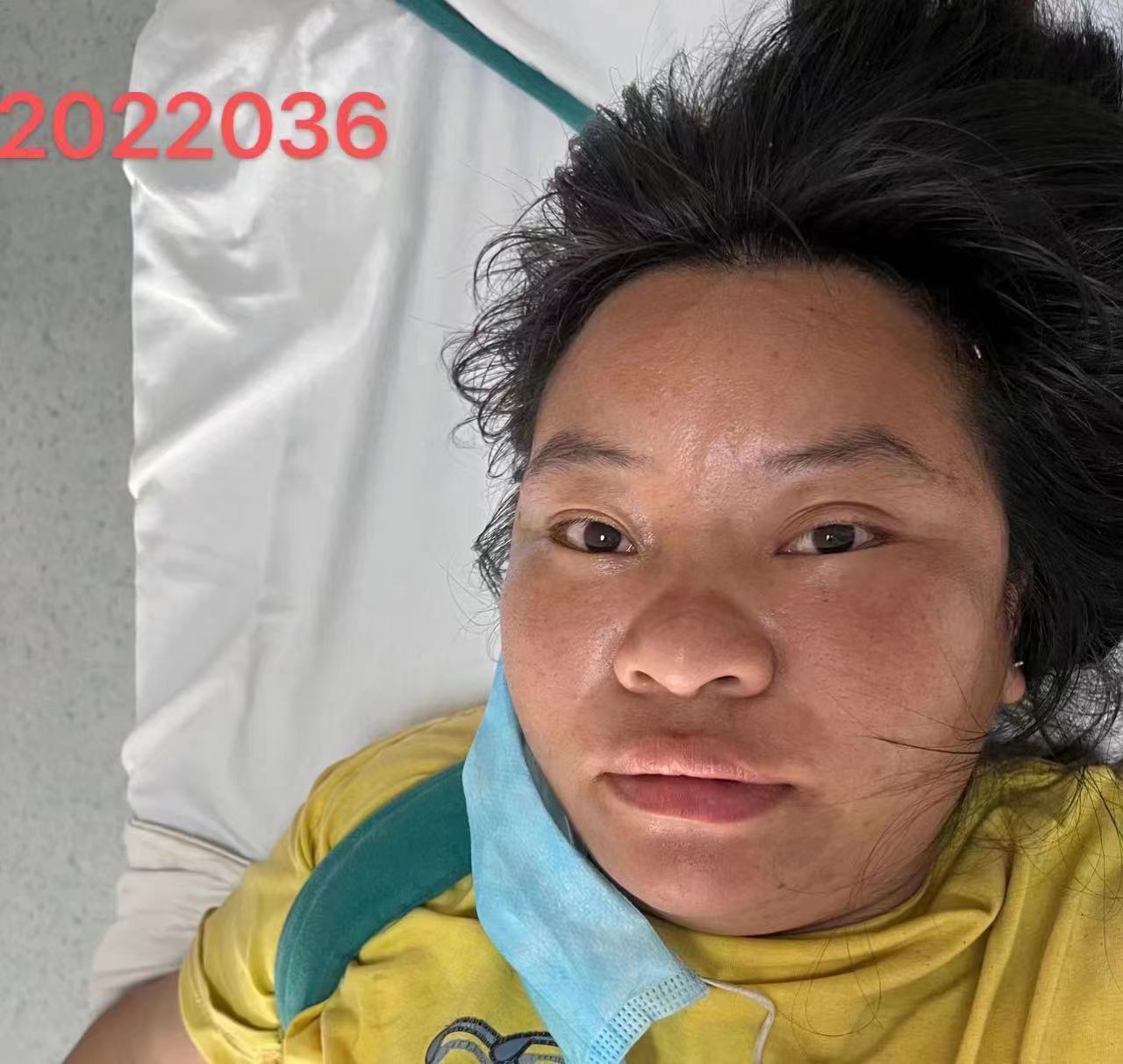 走失者照片 南宁寻亲：五旬女子被救助，自述叫李...
