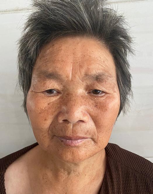 走失者照片 急寻亲属：六旬老太在宿迁被救助，高...