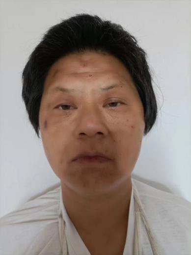 走失者照片 南阳寻亲：五旬女子被救助，高1米5...