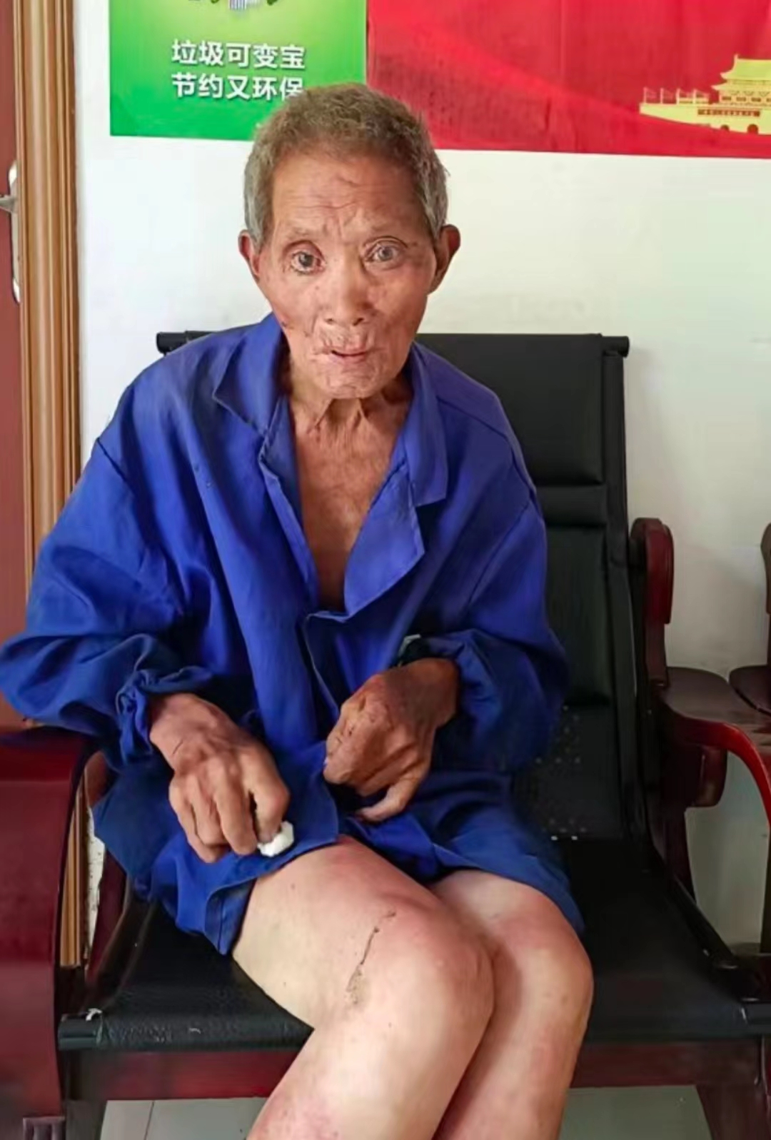 走失者照片 九江寻亲：七旬老人被救助，自述叫石...