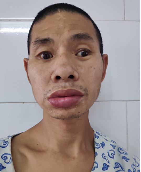 走失者照片 广州寻亲：青年男子被救助，自述叫卢...