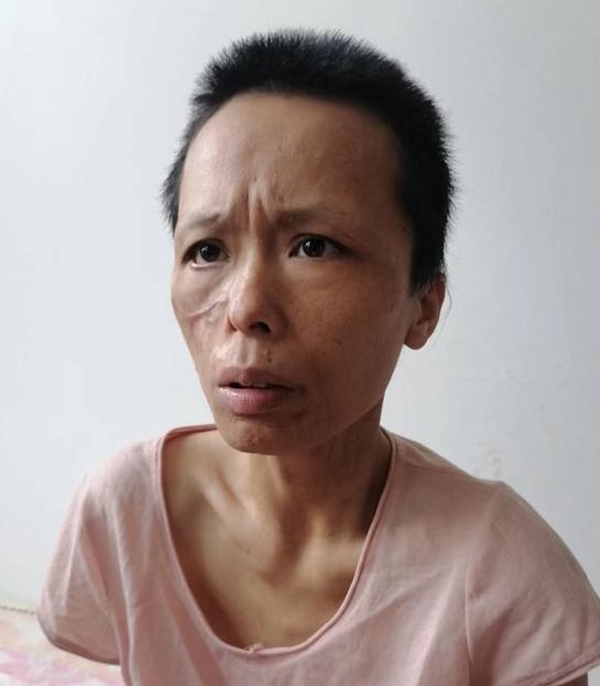 走失者照片 邯郸寻亲：中年女子被救助，穿蓝色棉...