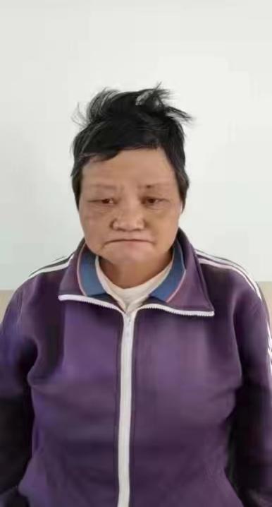 走失者照片 昆明寻亲:青年女子被救助,自述叫王...