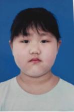 走失者照片 邯郸寻亲：7岁女童被救助，患先天心...