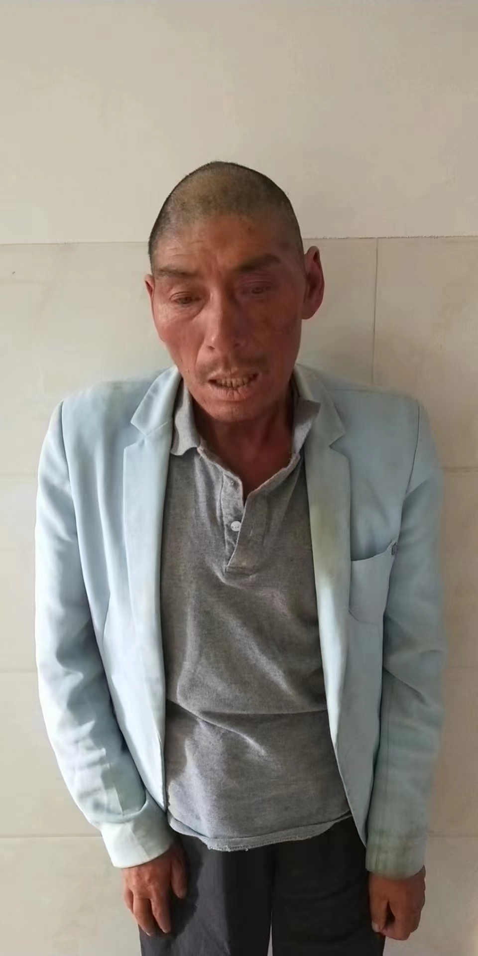 走失者照片 昆明寻亲：中年男子被救助，自述叫小...