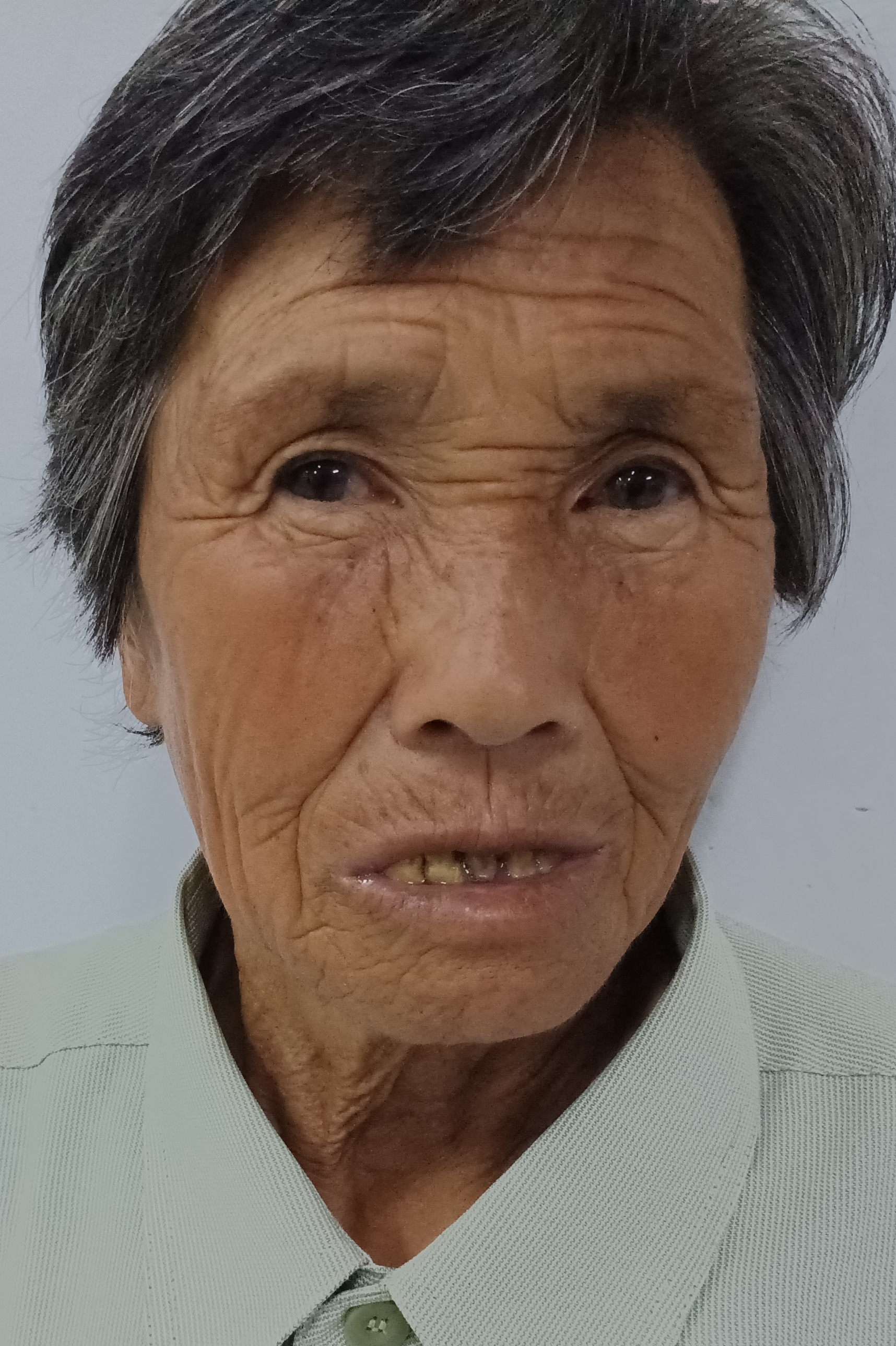 走失者照片 全国救助站