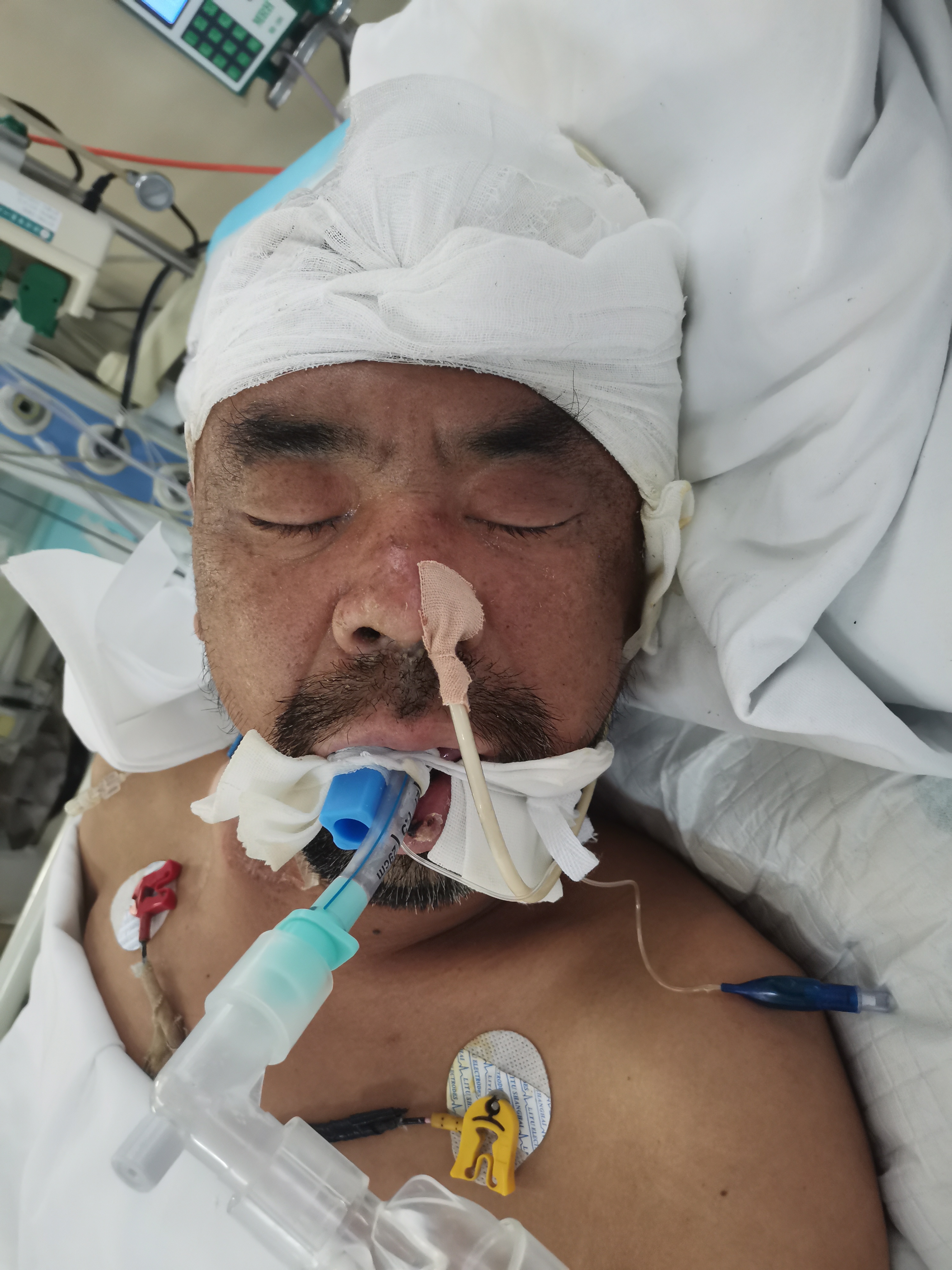 走失者照片 郑州寻亲：五旬男子被救助，穿黑色衣...