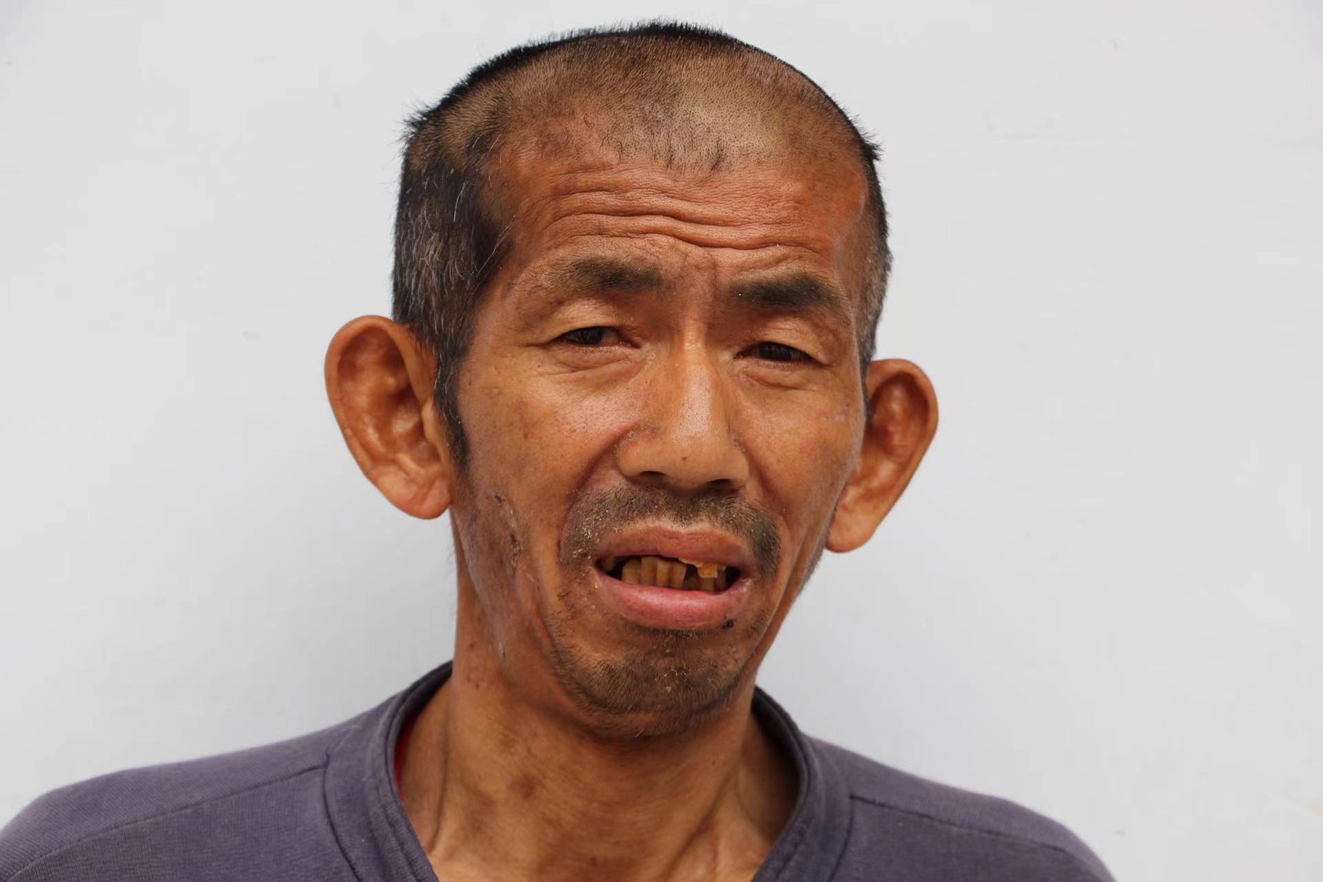 走失者照片 临沂寻亲：中年男子被救助，高1米7...