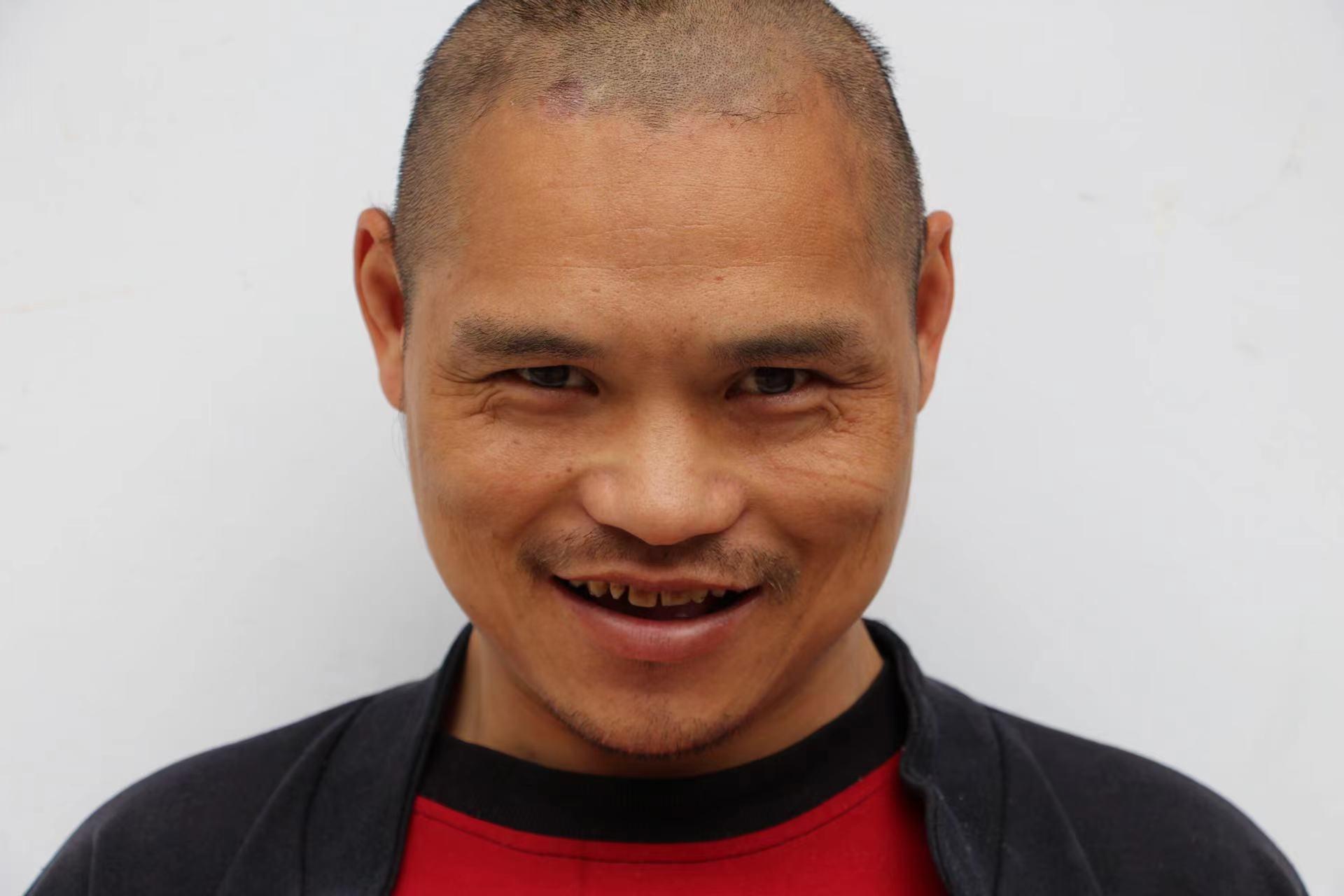 走失者照片 临沂寻亲：青年男子被救助，高1米6...