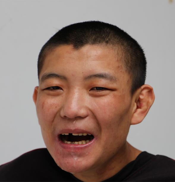 走失者照片 临沂寻亲：青年男子被救助十年，被救...