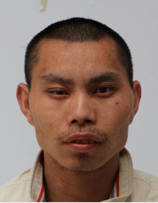 走失者照片 急寻家属：临沂青年男子被救助近十年...