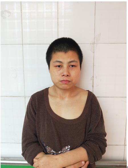 走失者照片 临沂寻亲：青年女子被救助，高1米5...