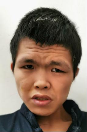 走失者照片 临沂市寻亲：17岁少年被救助，高1...