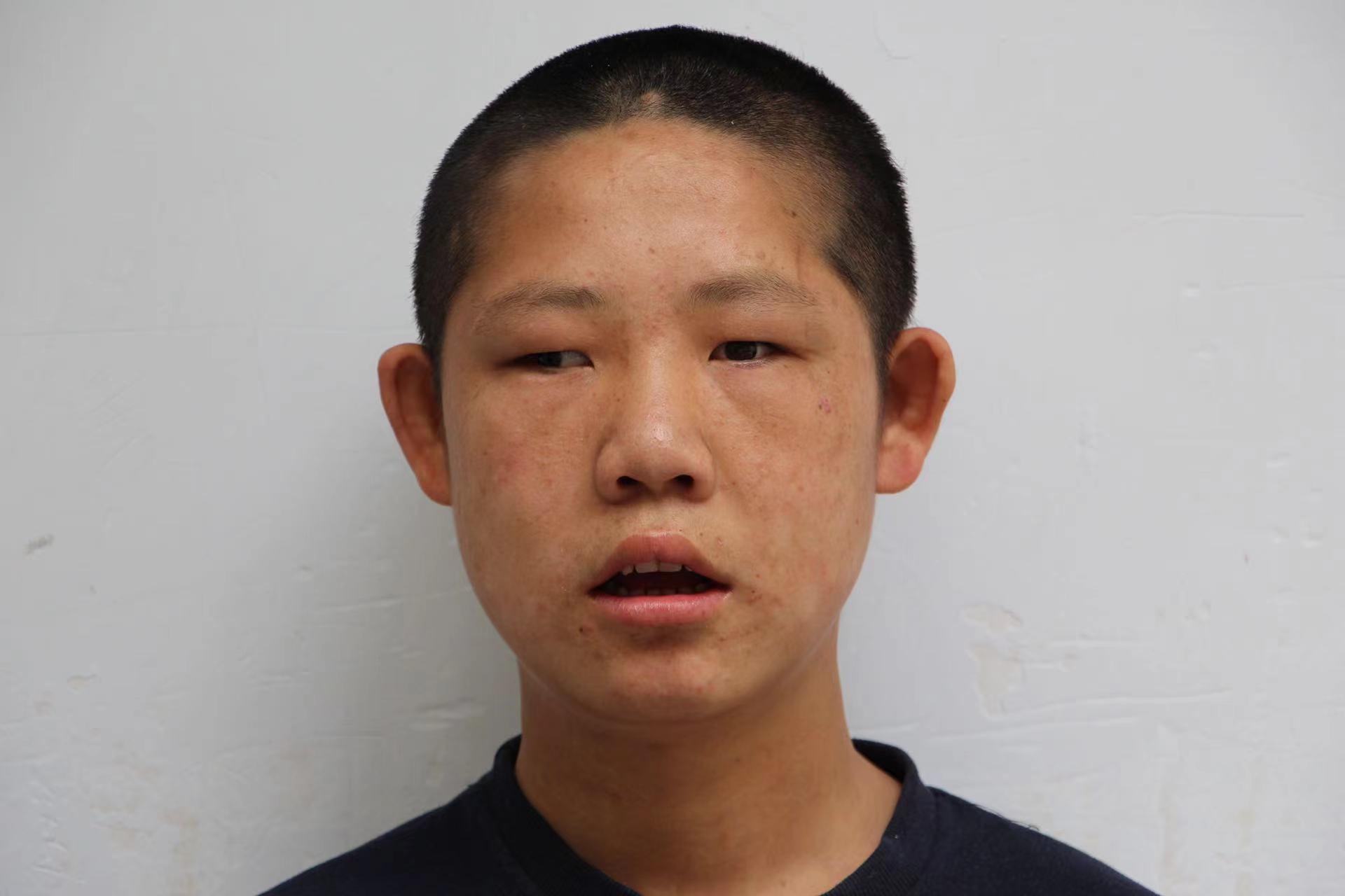 走失者照片 临沂寻亲：16岁男孩少年被救助多年...
