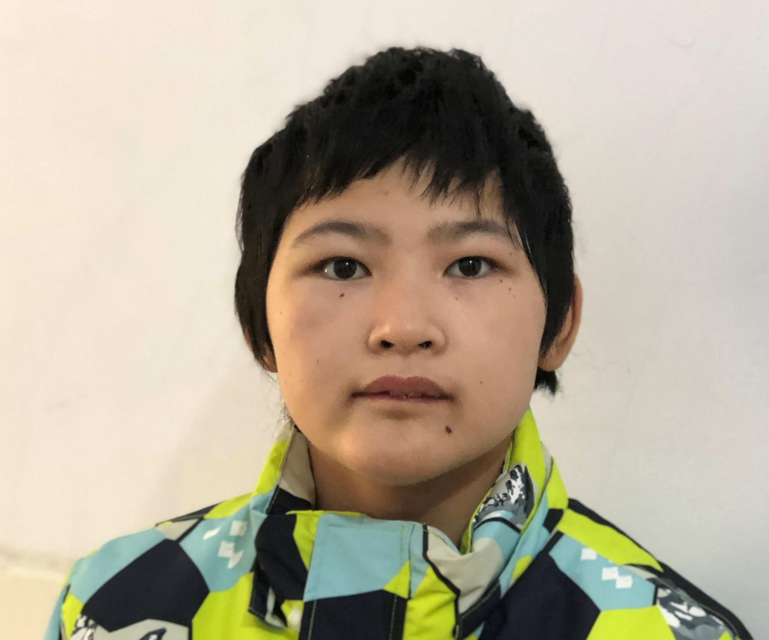 走失者照片 急寻家属：临沂15岁女孩被救助，口...