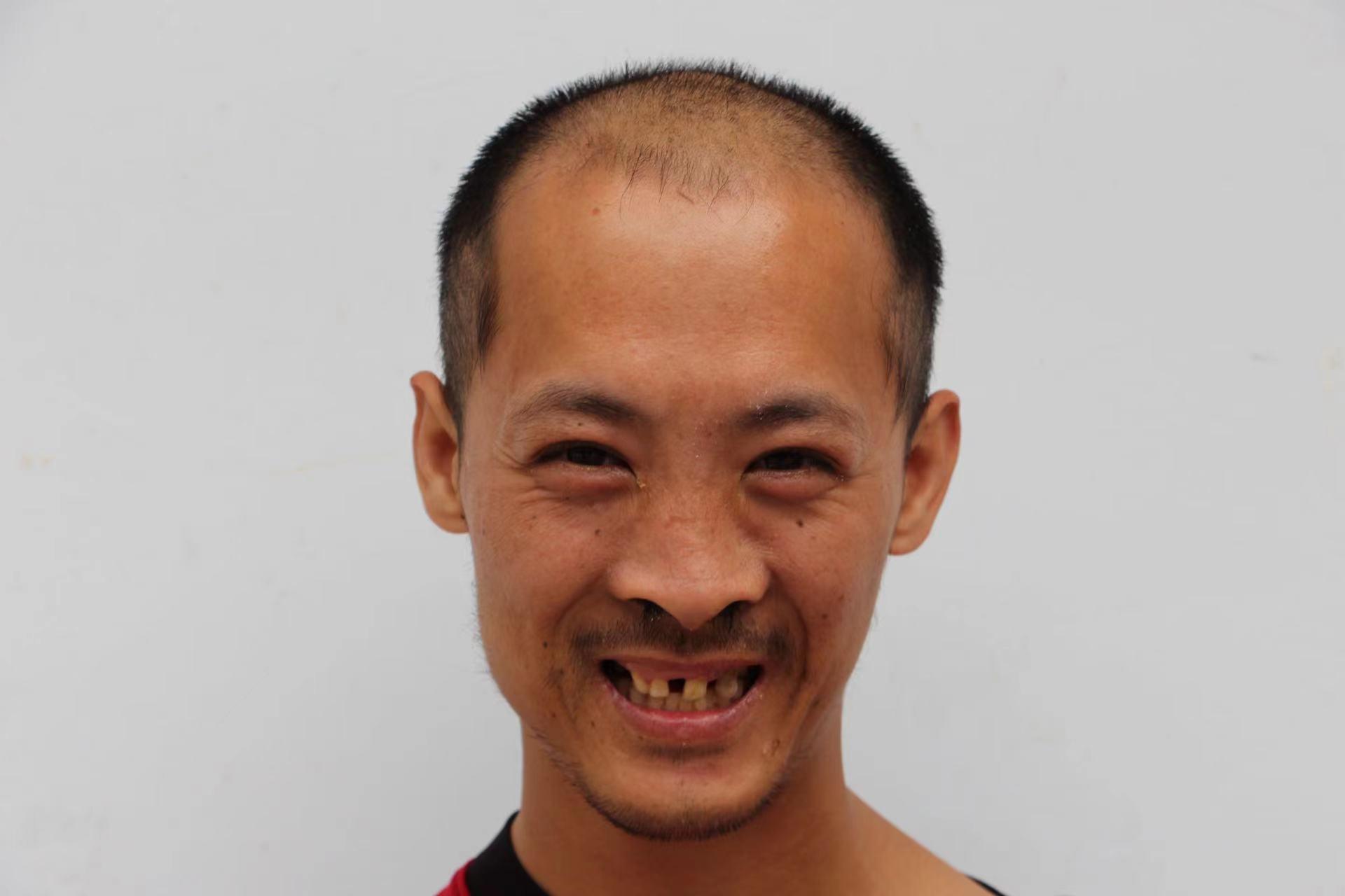 走失者照片 临沂寻亲：青年男子被救助，高1米6...