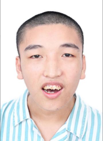 走失者照片 南阳寻亲：青年男子在佛山被救助多年...