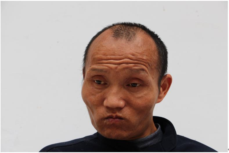 走失者照片 临沂寻亲：青年男子被救助，高1米7...