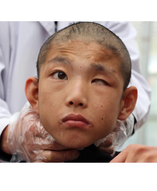 走失者照片 急寻父母！临沂10岁男孩被救助，高...