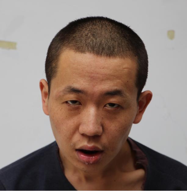 走失者照片 临沂寻亲：青年男子被救助十余年，高...