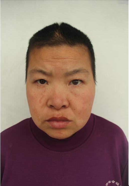 走失者照片 临沂青年女子被救助，高1米62，重...