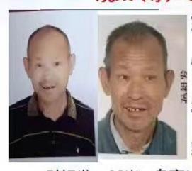 走失者照片 宣城急寻：六旬老人失联，穿米灰色上...