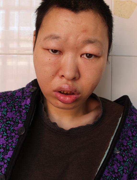 走失者照片 急寻亲友：临沂中年女子被救助，高1...